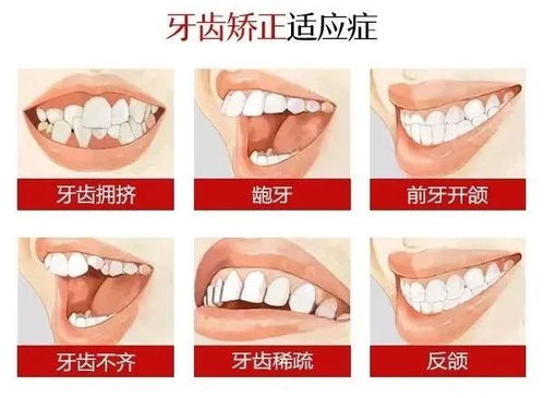 三点：