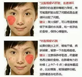 玄学维度中的暗疮位置:命运密码抑或心理投射?
