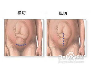 二、  实证剖析：2024年剖腹产择吉案例研究