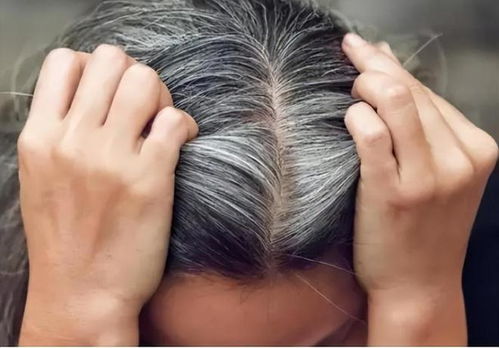 梦见满头白发预示着什么是健康预警还是人生新阶段的象征？