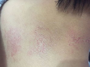 长腋毛是否预示着某种特殊命运的降临？