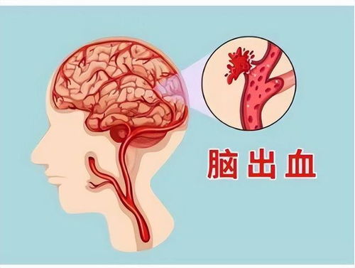 北方是大凶之地！