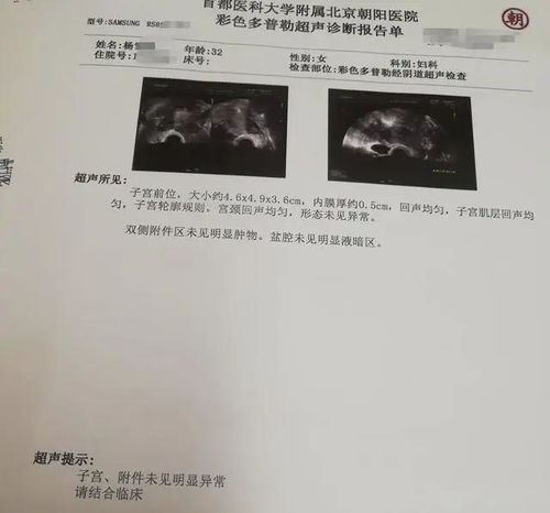 3. 子宫内膜相关检查（必选！）