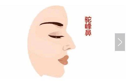 二、驼峰鼻：性格古怪不容简单缠