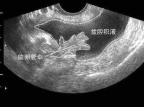 2. 引起缓慢性疼痛