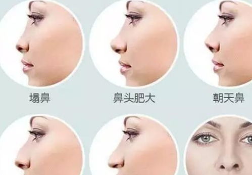 2. 鹰钩鼻：精明果敢却易招惹是非