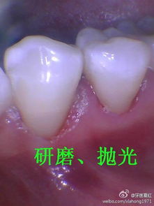 其他潜在病理状态及其临床表现概览