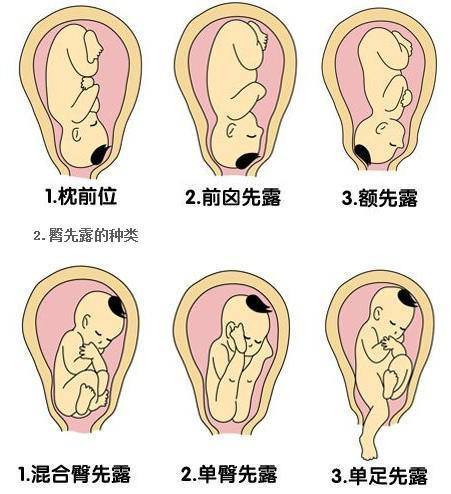 九、耳轮坚实