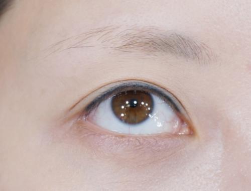 3. 其他潜在疾病的可能性