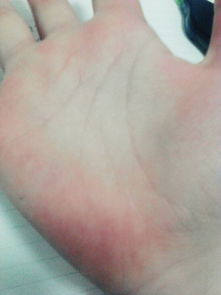 二、  双手食指有痣：命运轨迹的分裂与重组