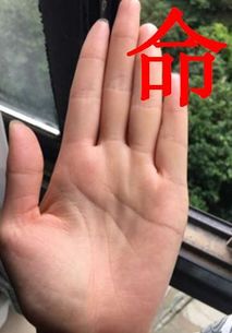 一、 1. 发干额窄30岁前无多余钱