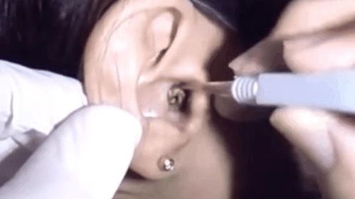 梦见老公耳朵里掏出针，这预示着什么？是吉是凶？