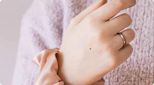 女人手背上的痣，哪种形状的痣被认为是最吉祥的？