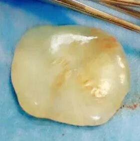 台州婴儿出生时竟带着一块玉，这是怎么回事？