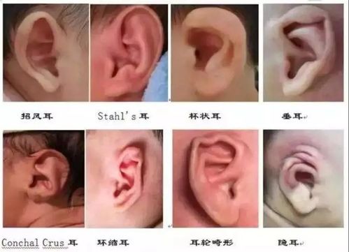 1. 耳廓整体轮廓