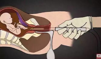 科学视角下的因果关系缺失