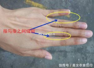 二、 烦恼线的位置与形态