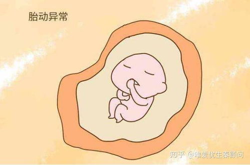 五、 胎动改变及相关感觉