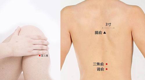 胸部胎记：情感与勇气的双重象征