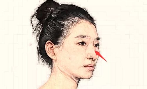 3. 鼻梁歪斜——自私自利与金钱至上观念凸显