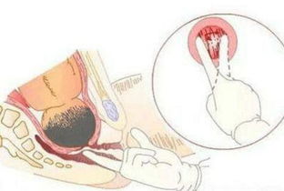 4. 十指弯曲与骨节暴露的命理暗示