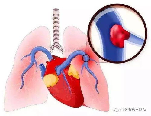 梦境解析：静脉血管的象征意义