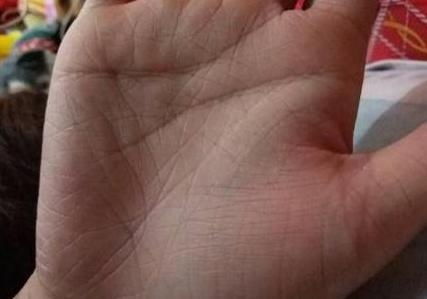 特殊纹路及其解读价值