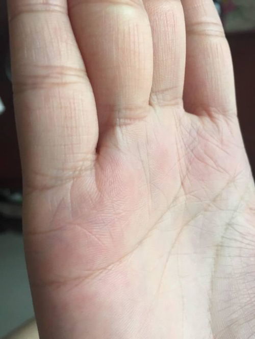 手相中妻妾位置大代表什么？婚姻宫位置如何改写？