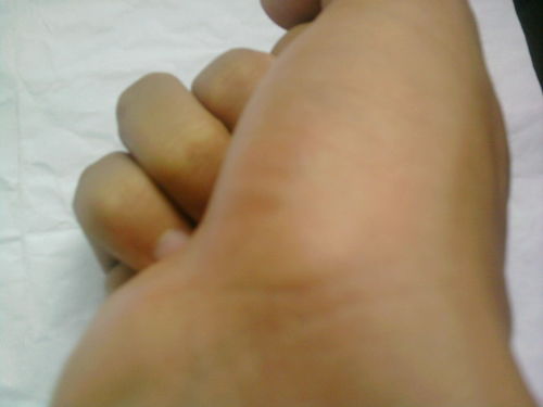 ：相学视域下左手腕痣相的符号学意义与性别差异