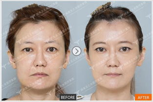 案例分析：演员的面相变迁与角色局限