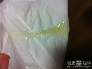 排卵期出血 vs. 妇科病症