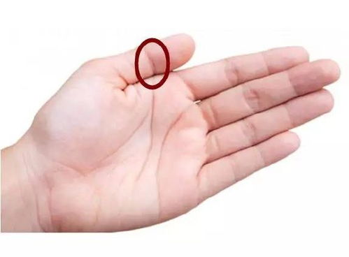 3. 指形、 关节突出及掌温等生理表现