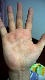 东西方手相大PK