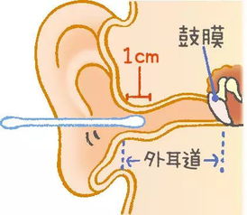 1. 耳朵整体形态