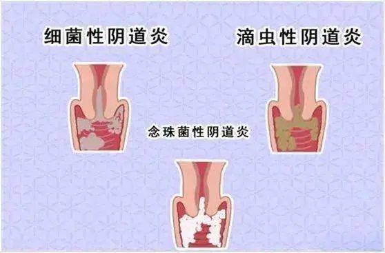 日常生活中的注意事项