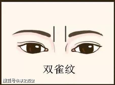 额头八字纹女孩命运如何？如何有效祛除额头纹改善运势？