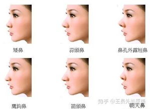 鼻子塌的女生风水运势会不好吗？