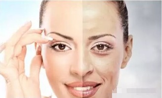 唇角皱纹对皮肤健康的潜在影响