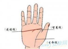 一、 断掌手相的基本定义及其统计分布