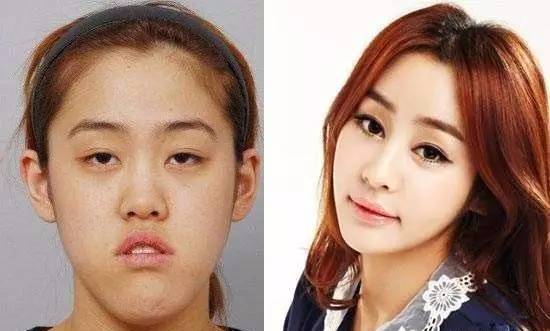 从风水角度解读塌鼻梁与个人运势