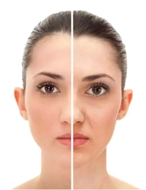 脸上法令纹彳艮深是什么原因造成的？