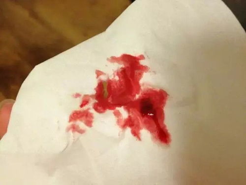 我为什么会梦见地上一滩鲜红的血？这预示着什么？