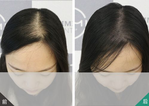 剪头发后运势真的会变好，这是光头风水学说的神奇之处吗？