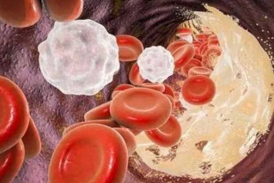 （五）辛辣刺激及酒精类饮品