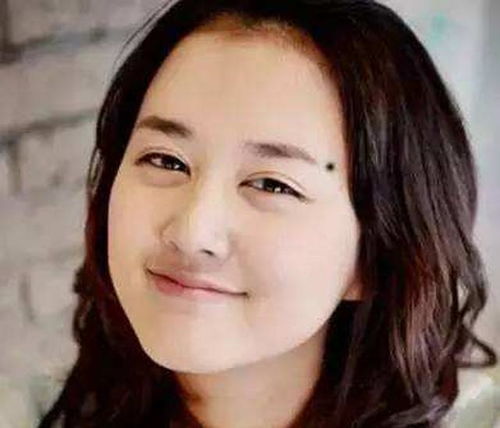 2. 腮部（颧骨下方）的“临老入花丛”现象