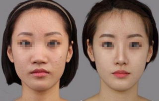 三、 夫妻双方鼻相对比及家庭权威分配