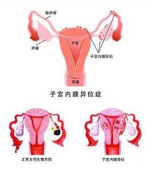 子宫性不孕医治去哪里那个？这几家医院让你不再焦虑！