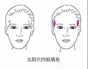1.2 太阳穴饱满与凹陷之象征意义