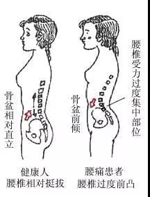 一、 久坐对脊柱及整体身体健康状况之潜在危害