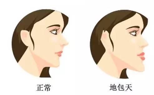 四、 龅颌（即“龅牙”）所暗示的粗犷心理及冲突易发性